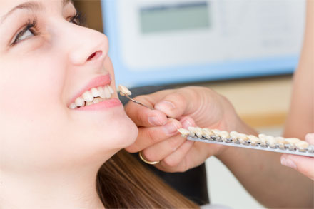 Ermittlung der Zahnfarbe einer lächelnden Patientin